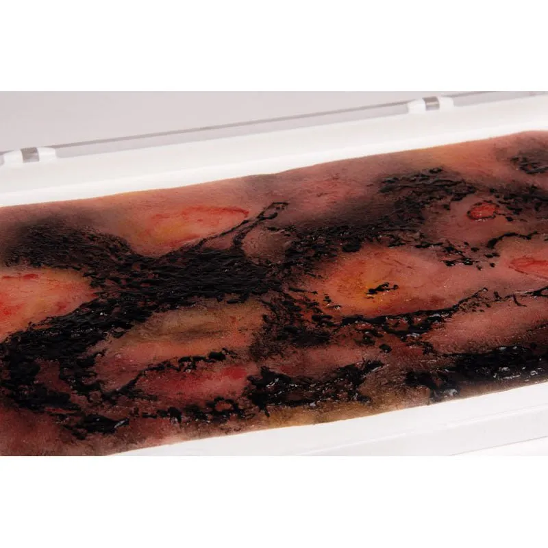 Wound Moulage 3rd Degree Burn Kit